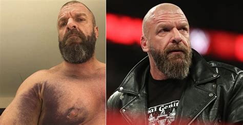 triple h paul levesque|paul michael levesque heart attack.